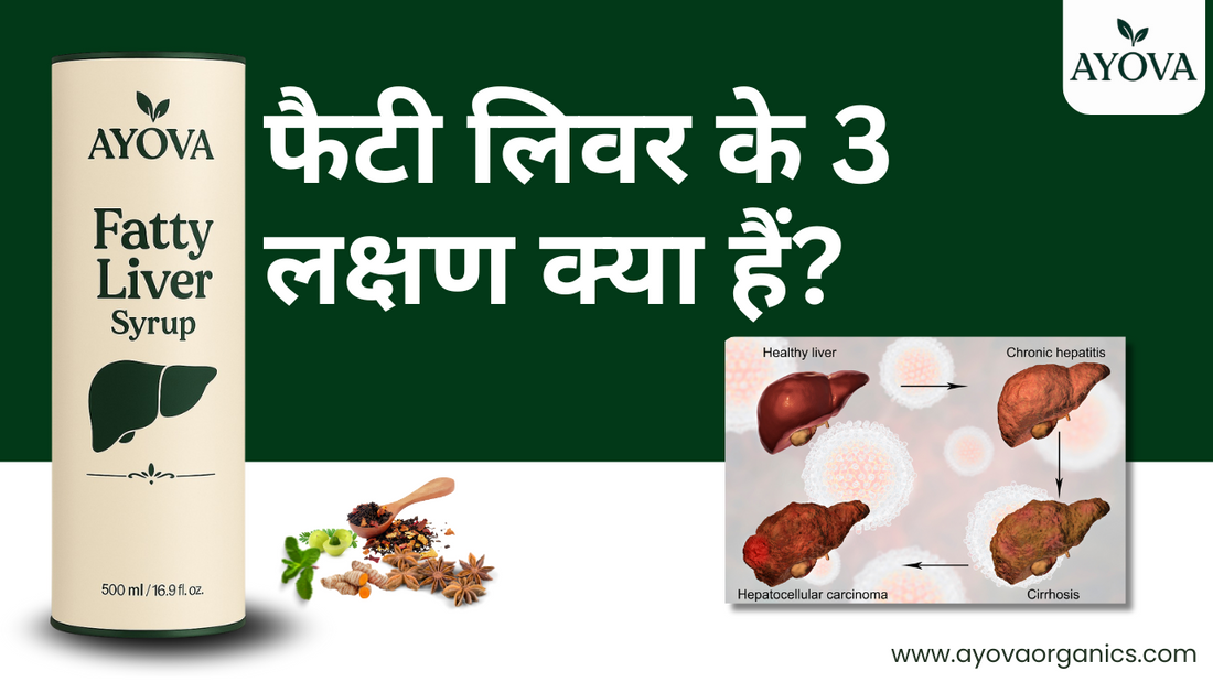 फैटी लिवर के 3 लक्षण क्या हैं?