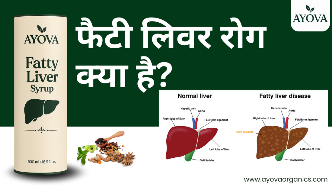 फैटी लिवर क्या है? कारण, लक्षण और इलाज जानिए